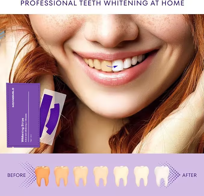 SmileKit™ | Bandes Blanchissantes – Sourire Plus Blanc en 30 Minutes