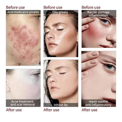 345 Crème Apaisante, Hydratant pour Visage